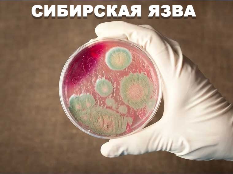 Сибирская язва: памятка для животноводов.